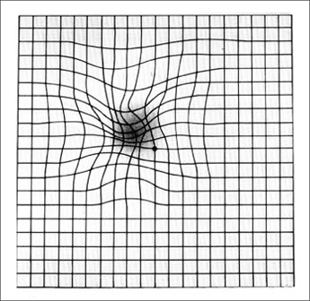 amsler grid for someone with age related macular degeneration